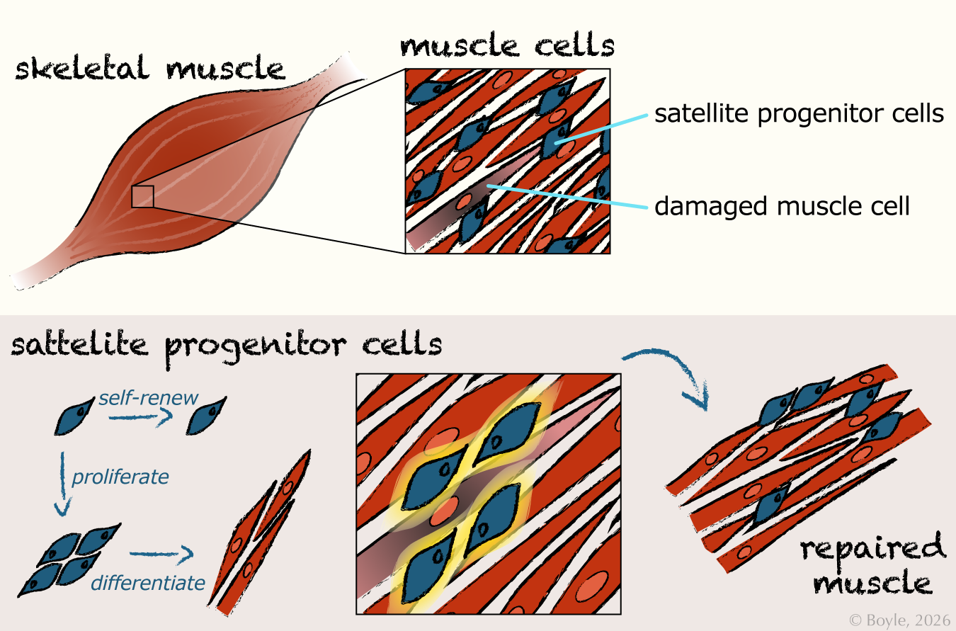 An illustration showing how satellite progenitor cells repair skeletal muscle. The top part of the image displays a stylized drawing of a skeletal muscle, with a magnified view of individual red and white muscle fibers. Within the zoomed‑in area, blue satellite progenitor cells sit along the edges of the fibers, near an orange damaged muscle cell. The bottom part of the image shows satellite progenitor cells dividing through self‑renewal, proliferation, and differentiation. Arrows indicate their progression as they multiply and develop into elongated muscle cells. A final panel shows the repaired muscle fibers arranged in an orderly pattern.