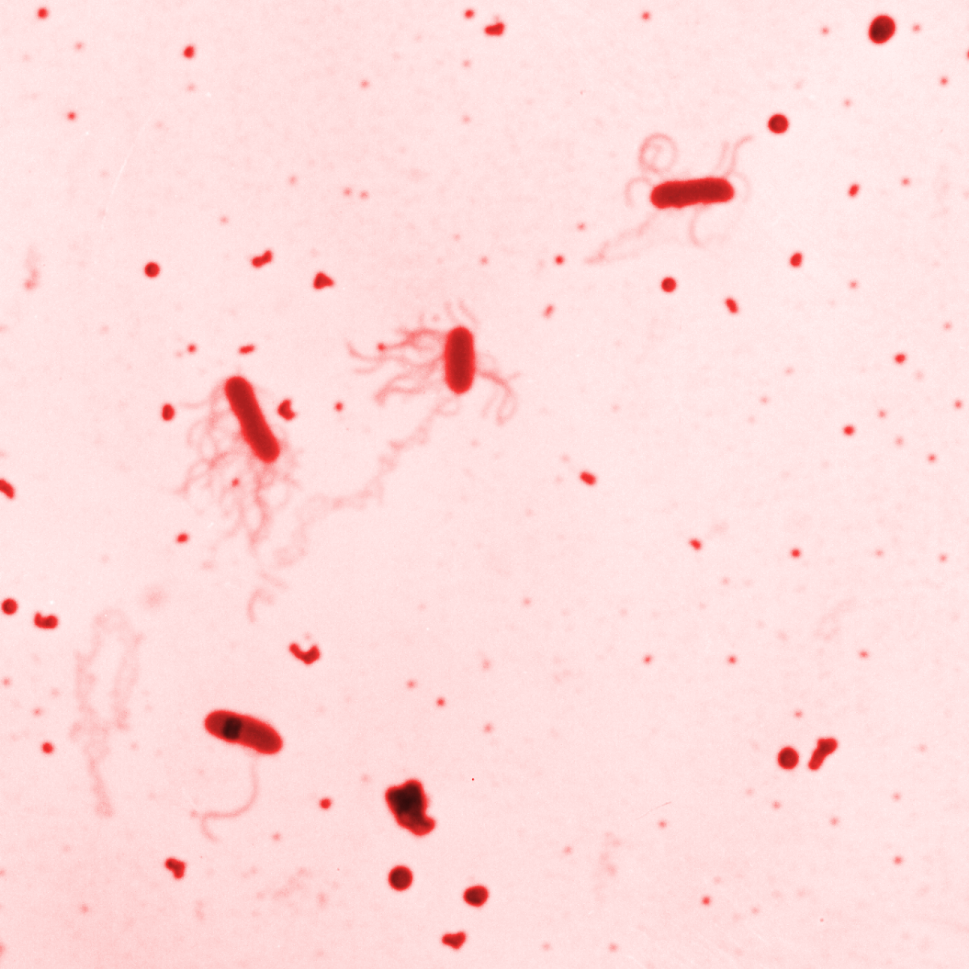 Microscope image showing several rod‑shaped bacteria stained red against a pale pink background, with some cells displaying thin, hair‑like filaments extending from their surface. Image from the Centers for Disease Control.
